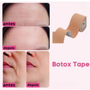 Botox Type efeitos em 24 horas