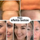Botox Type efeitos em 24 horas
